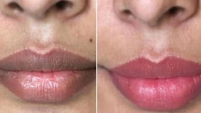 Here’s how you can get pink lips with these simple home remedies