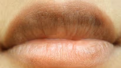 Do you feel ashamed for your dark, pigmented lips? Here are some quick fixes