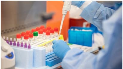 കൊവിഡ് ബാധിച്ച് രോഗമുക്തരായവര്ക്ക് വീണ്ടും രോഗം പിടിപെടുമോ? പുതിയ പഠനം പറയുന്നത്