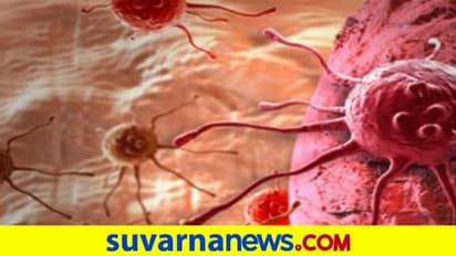 'ಬೇಗ ಕ್ಯಾನ್ಸರ್‌ ಗುಣಪಡಿಸಬಹುದು'