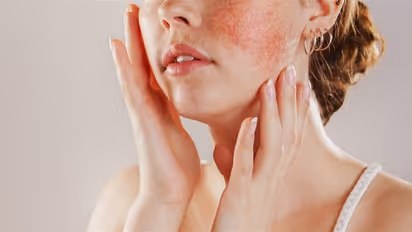 എന്തുകൊണ്ട് മുഖത്ത് പാടുകളും നിറവ്യത്യാസങ്ങളും?; പരിഹാരമായി ചെയ്യാവുന്നത്...