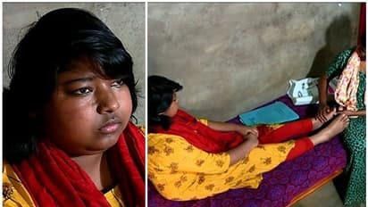 വേദനകളുടെയും മരുന്നുകളുടെയും ലോകത്ത് നിന്ന് മോചനം വേണം, സുമനസ്സുകളുടെ സഹായം തേടി സ്നേഹമോള്