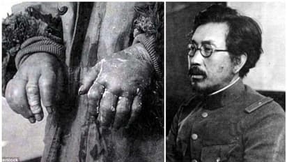 കോൺസൻട്രേഷൻ ക്യാമ്പ് ഒന്നുമല്ല, ഈ ജാപ്പനീസ് ഡോക്ടർ തടവുകാരെ വിധേയരാക്കിയത് നാസികളെ വെല്ലുന്ന ക്രൂരതകൾക്ക്