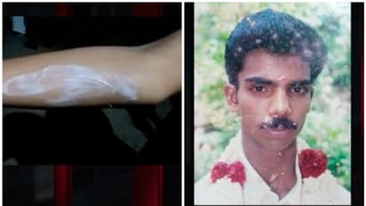 ഭാര്യയ്ക്കും മകള്ക്കും നേരെ ആസിഡ് ആക്രമണം; യുവാവിനെ പൊലീസ് തിരയുന്നു