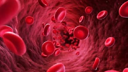 ಕಬ್ಬಿಣಾಂಶದ ಕೊರತೆಯೇ? ಇಲ್ಲಿವೆ ಸಮಸ್ಯೆ ನಿವಾರಿಸುವ ಆಹಾರಗಳು