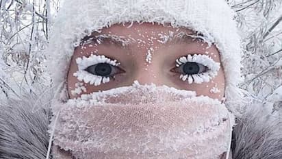 Health Tips: ಚಳಿಗಾಲದ ಕಿರಿಕಿರಿ ಬೇಡವಾದ್ರೆ ಹೀಗ್ಮಾಡಿ