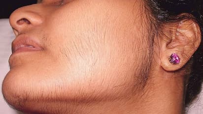 মুখের অবাঞ্ছিত লোম নিয়ে অস্বস্তিতে ভোগেন, পার্লারের খরচ বাঁচিয়ে কাজে লাগান এই উপাদান