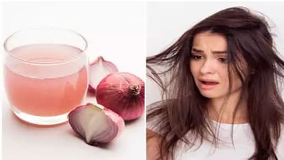 Treat hair fall with onions, an economical way to promote hair growth