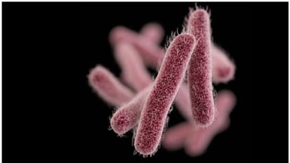 Symptoms Of  Shigella : ഷിഗല്ല; ഈ ലക്ഷണങ്ങൾ നിസാരമായി കാണരുത്