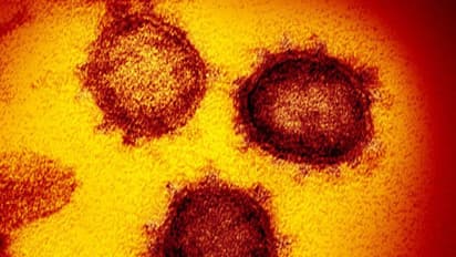 Britain returnee tests positive for COVID-19, Bengaluru under scare, sample sent to NIMHANS