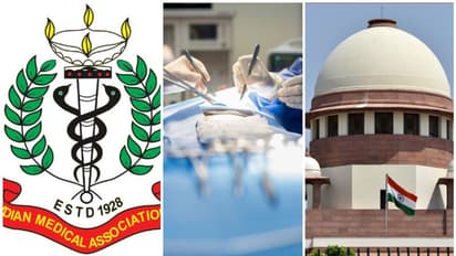 ആയുര്വേദ ഡോക്ടര്മാര്ക്ക് ശസ്ത്രക്രിയ നടത്താനുള്ള അനുമതി; സുപ്രീംകോടതിയെ സമീപിച്ച് ഐഎംഎ