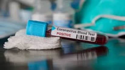 സ്വദേശി സ്ത്രീയില് നിന്ന് കൊവിഡ് ബാധിച്ചത് ഒരേ കുടുംബത്തിലെ ഒമ്പത് പേര്ക്ക്