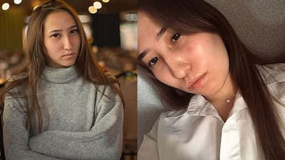 10 आवारा कुत्तों ने मिलकर नोच डाला ब्यूटीशियन का चेहरा, आंख-होंठ  चबा गए जंगली दरिंदे