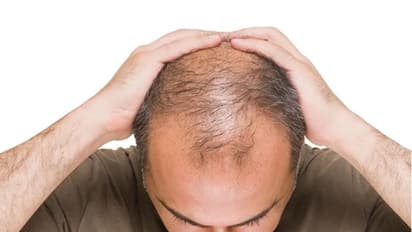 Stop hair fall: Six natural home remedies for hair growth