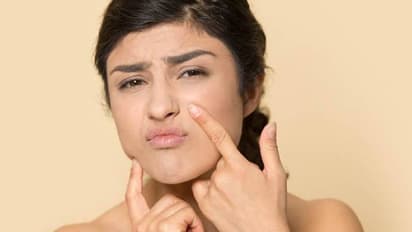 വരണ്ട ചര്‍മ്മമാണോ? പരീക്ഷിക്കാം ഈ അഞ്ച് ഫേസ് പാക്കുകള്‍...