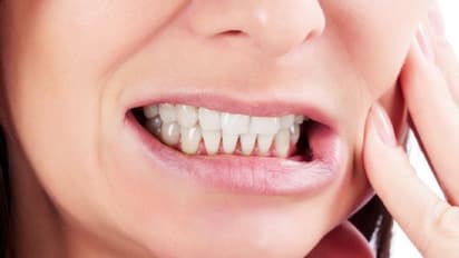 ಹುಳುಕಾಗಿರುವ ಹಲ್ಲುಗಳನ್ನು ಸರಿ ಪಡಿಸಲು 6 ನೈಸರ್ಗಿಕ ಮಾರ್ಗಗಳು