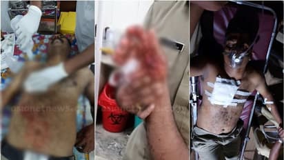 ആലപ്പുഴയിൽ രണ്ടിടത്ത് പൊലീസുകാർക്ക് നേരെ പ്രതികളുടെ ആക്രമണം