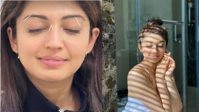 వైరల్ ఫొటో : మొహానికి సూదులతో ప్రణీత