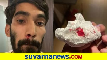 ಕೋವಿಡ್‌ ಪರೀಕ್ಷೆ ವೇಳೆ ಮೂಗಲ್ಲಿ ರಕ್ತ: ಶ್ರೀಕಾಂತ್‌ ಕಿಡಿ!