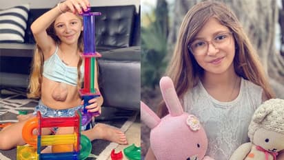 ये कैसी जिंदगी: सीने के बाहर धड़कता है इस मासूम का दिल, इसमें है छेद भी, ऐसी रहती है हालत