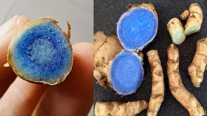 Weight Loss Tips : ತೂಕ ಇಳಿಸೋ ಚಿಂತೆ ಬಿಡಿ, ಕಪ್ಪು ಅರಿಶಿನ ಬಳಸಿ