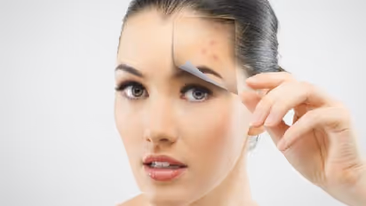 ব্রণের সমস্যায় ভুগছেন, তবে আজ থেকেই পান করুন এই ৫টি পানীয়