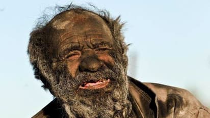 ৬৫ বছর স্নান করেননি, খান পচা মাংস - জেনে নিন বিশ্বের নোংরাতম মানুষের কাহিনি, ছবিতে ছবিতে