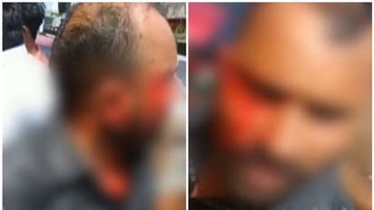 യുവാവിനെ കസ്റ്റഡിയില്‍ എടുക്കുന്നതിൽ തര്‍ക്കം; ഈരാറ്റുപേട്ടയിൽ പൊലീസും നാട്ടുകാരും തമ്മിൽതല്ല്