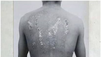 ഇന്ത്യൻ സൈനികരുടെമേൽ ബ്രിട്ടൻ നടത്തിയ ക്രൂരമായ രാസായുധ പരീക്ഷണങ്ങൾ...