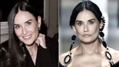 'പ്ലാസ്റ്റിക് സര്‍ജറി ദുരന്തമാണോ?'; പ്രമുഖ നടിയുടെ ചിത്രങ്ങള്‍ വൈറലാകുന്നു