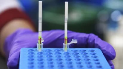 ಬಾವಲಿಯಿಂದ ಮನುಷ್ಯನಿಗೆ ಹರಡಬಲ್ಲ ಹೊಸ HKU5-CoV-2 ಕೊರೋನಾ ವೈರಸ್ ಪತ್ತೆ