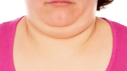 কৌশল করে ঢেকে ফেলুন ডবল চিন, রইল কয়টি সহজ টোটকা, মুহূর্তে পাবেন নিখুঁত চোয়াল