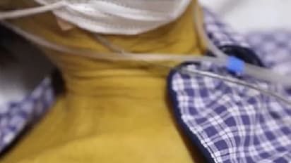 ദേഹം മുഴുവന് മഞ്ഞനിറമായി അറുപതുകാരന്; വില്ലനായത് കടുത്ത പുകവലി