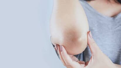 मिनटों में गायब हो जाएगा गर्दन-कोहनियों का कालापन? जबरदस्त हैं ये घरेलू नुस्खे