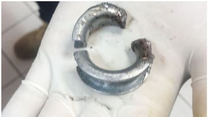 ಪ್ರೇಯಸಿಗೆ ವಿಶಿಷ್ಟ ಗಿಫ್ಟ್ ಕೊಡುತ್ತೇನೆ ಎಂದು ಶಿಶ್ನಕ್ಕೆ ರಿಂಗ್ ಸಿಕ್ಕಿಸಿಕೊಂಡ..ಆಮೇಲೆ!