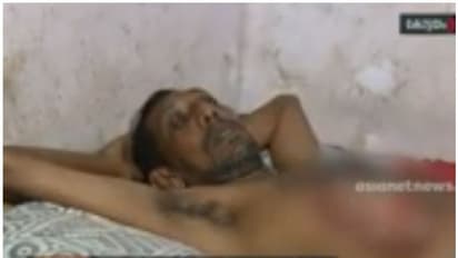 മാനസിക വെല്ലുവിളി നേരിടുന്നയാളുടെ ദേഹത്ത് തിളച്ചവെള്ളം ഒഴിച്ച് ബസ് കണ്ടക്ടറുടെ ക്രൂരത