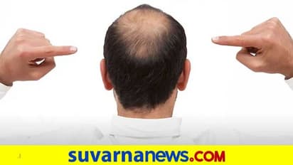 ಮದುವೆಗೆ ಮುನ್ನ ವಿಗ್ ಧರಿಸಿ ಬಾಲ್ಡಿ ತಲೆ ಮರೆಮಾಚಿದ್ದ ಗಂಡನಿಂದ ಬಿಡುಗಡೆ ಕೊಡಿಸಿ!