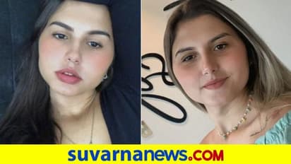 ಅವಳಿ-ಜವಳಿಗೆ ಲಿಂಗ ಪರಿವರ್ತನೆ ಚಿಕಿತ್ಸೆ: ವಿಶ್ವದಲ್ಲೇ ಮೊದಲ ಪ್ರಕರಣ!