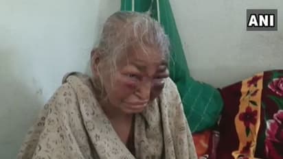 'তিনি কি বাংলার মা নন', রাজ্যের নির্যাতিতা মহিলার ছবি দিয়ে তৃণমূলকে নিশানা বিজেপি নেতার