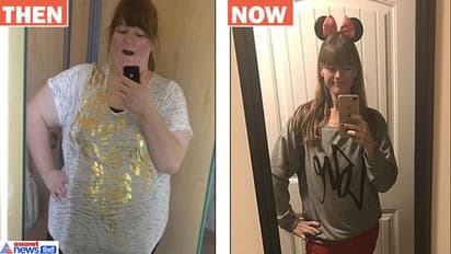 weight loss story: 190 किलो की लड़की ने घटाया 127 kg वजन, वेट लॉस जर्नी है बहुत दर्दनाक