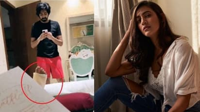 నిహారిక కాలుకి గాయం.. బుజ్జగిస్తున్న చైతన్య..