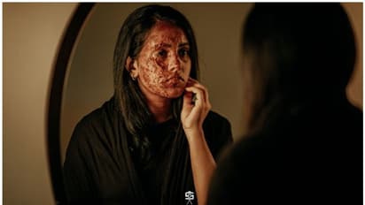 ലോക വനിതാ ദിനം; ആസിഡ് ആക്രമണത്തിന് ഇരയായ സ്ത്രീകള്‍ക്ക് ആദരമര്‍പ്പിച്ച് ഒരു ഫോട്ടോഷൂട്ട്