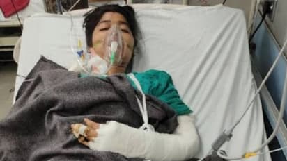 राक्षस बना पति: पत्नी की हथेली और पैर का पंजा काट डाला, बोला-इसी फरसे से पुलिस को भी मारूंगा