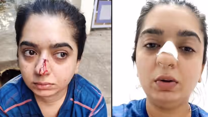 Zomato assault case: Beauty influencer Hitesha Chandranee flees Bengaluru after police complaint and trolls