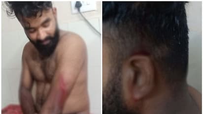ഒറ്റപ്പാലത്ത് യൂത്ത് കോൺഗ്രസ് പ്രവർത്തകന് വെട്ടേറ്റു; രാഷ്ടീയ പ്രേരിതമെന്ന് ആരോപണം