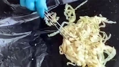 ಈತನ ಹೊಟ್ಟೆಯಲ್ಲಿತ್ತು 4 ಅನಕೊಂಡದಷ್ಟು ಉದ್ದ ಹುಳ, ತೆವಳುತ್ತಾ ಗುಪ್ತಾಂಗ ತಲುಪಿತ್ತು!