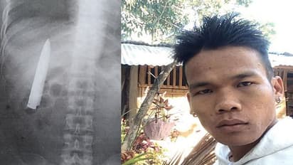 ठंड बढ़ते ही शख्स के सीने में होने लगता था दर्द, X-Ray रिपोर्ट में दिखी खौफनाक चीज