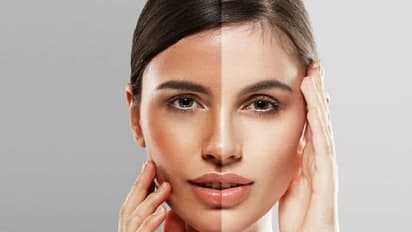 വെയിലേറ്റ് കരുവാളിച്ചോ? അടുക്കളയിലുണ്ട് പരിഹാരം!