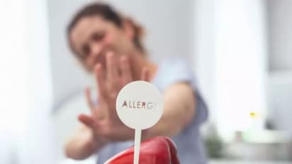 Health Tips: ನಿಮಗೆ ಫುಡ್ ಅಲರ್ಜಿ ಇದೆ ಅನ್ನೋದನ್ನು ತಿಳಿಯೋದು ಹೇಗೆ? 