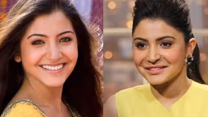 Yes, Anushka Sharma got a lip-job, she accepted it too; says 'I’m human and not perfect'